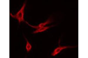 ABIN6274565 staining Hela cells by IF/ICC.