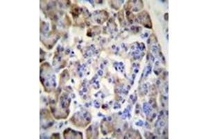 Immunohistochemistry (Paraffin-embedded Sections) (IHC (p)) image for anti-Midkine (Neurite Growth-Promoting Factor 2) (MDK) (AA 110-143), (C-Term) antibody (ABIN953444)