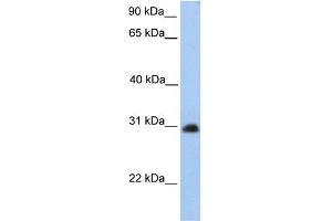 WB Suggested Anti-CHST14 Antibody Titration:  0. (CHST14 Antikörper  (Middle Region))