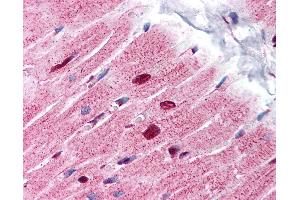 Anti-ANP32A antibody IHC of human heart. (PHAP1 Antikörper  (C-Term))