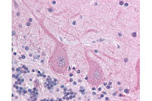 Anti-ACCN4 antibody IHC of human brain, cerebellum. (ACCN4 Antikörper  (AA 121-170))
