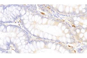 Immunohistochemistry (IHC) image for anti-Tryptase alpha/beta 1 (TPSAB1) (AA 151-275) antibody (ABIN7433102)