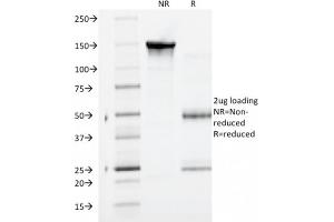 SDS-PAGE Analysis Purified Catenin, gamma Mouse Monoclonal Antibody (CTNG/1664). (JUP Antikörper)