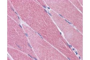 IHC testing of FFPE human skeletal muscle tissue with CREB3L1 antibody at 3. (CREB3L1 Antikörper)