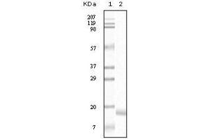 Western blot analysis using SNCA mouse mAb against truncated SNCA recombinant protein.