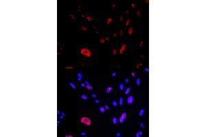 Immunofluorescence analysis of U2OS cells using HUS1 antibody (ABIN5973136). (HUS1 Antikörper)
