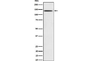 Western blot analysis of Phospho-BCAR1 (Y410) expression in HeLa treated with pervanadate cell lysate.
