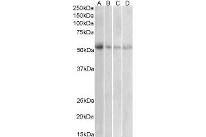 ABIN2560733 (1µg/ml) staining of Human Placenta (A), Human Uterus (B), Human Adrenal Gland (C) and Human Pancreas (D) lysates (35µg protein in RIPA buffer). (SLC18A2 Antikörper  (C-Term))