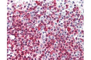 Anti-DKC1 antibody IHC of human spleen. (DKC1 Antikörper  (AA 446-460))
