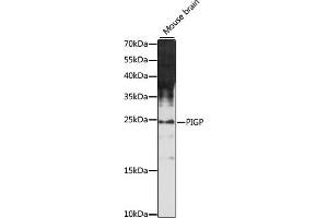 Western blot analysis of extracts of mouse brain, using PIGP antibody (ABIN7269289) at 1:1000 dilution. (PIGP Antikörper  (AA 25-158))