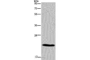 Western blot analysis of Mouse heart tissue, using CMTM5 Polyclonal Antibody at dilution of 1:400 (CMTM5 Antikörper)