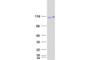 Western Blotting (WB) image for EPH Receptor B4 (EPHB4) protein (Myc-DYKDDDDK Tag) (ABIN2720251)