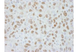 Immunohistochemistry (IHC) image for anti-Damage Specific DNA Binding Protein 1 (DDB1) (C-Term) antibody (ABIN7448511) (DDB1 Antikörper  (C-Term))