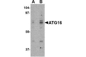 Western blot analysis of ATG16 in HeLa cell lysate with ATG16 antibody at (A) 0. (ATG16L1 Antikörper  (Center))