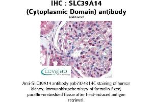 Image no. 1 for anti-Solute Carrier Family 39 (Zinc Transporter), Member 14 (SLC39A14) (Cytoplasmic Domain) antibody (ABIN1739369)