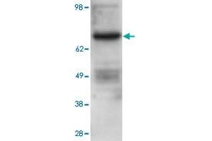 Western blot using PRKCB polyclonal antibody  shows detection of PRKCB in ~25 ug of U251 whole cell lysate (glioma derived).