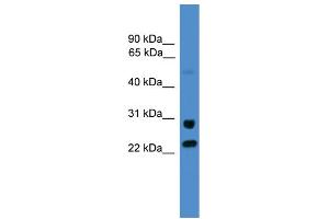 WB Suggested Anti-KIAA0152  Antibody Titration: 0. (Malectin Antikörper  (C-Term))