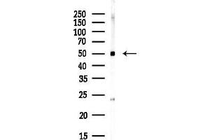 anti-Friend Leukemia Virus Integration 1 (FLI1) (Internal Region) antibody