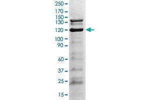 The tissue lysate derived from GH stimulated mouse liver was immunoblotted by JAK2 (phospho Y1007/Y1008) polyclonal antibody  at 1 : 500. (JAK2 Antikörper  (pTyr1007, pTyr1008))