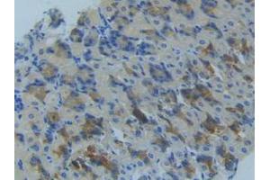 IHC-P analysis of Mouse Stomach Tissue, with DAB staining. (MMP14 Antikörper  (AA 121-487))