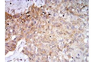 Immunohistochemistry (IHC) image for anti-Phospholipase D2 (PLD2) (AA 834-933) antibody (ABIN5881791) (Phospholipase D2 Antikörper  (AA 834-933))