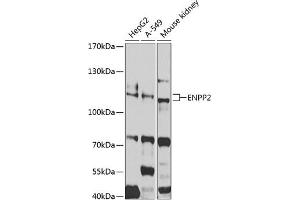 Western blot analysis of extracts of various cell lines, using ENPP2 antibody (ABIN3023333, ABIN3023334, ABIN3023335 and ABIN6219607) at 1:1000 dilution. (ENPP2 Antikörper  (AA 564-863))
