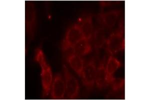 Image no. 3 for anti-Protein-tyrosine Phosphatase 1C (PTPN6) (Tyr536) antibody (ABIN197592) (SHP1 Antikörper  (Tyr536))