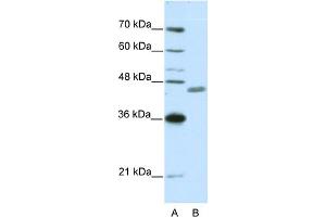 WB Suggested Anti-ZNF396 Antibody Titration:  0. (ZNF396 Antikörper  (N-Term))