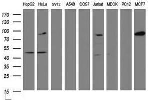 Image no. 2 for anti-ATR Interacting Protein (ATRIP) (AA 42-309) antibody (ABIN1491509) (ATRIP Antikörper  (AA 42-309))