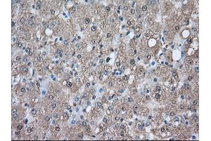Immunohistochemical staining of paraffin-embedded Human prostate tissue using anti-PIM2 mouse monoclonal antibody. (PIM2 Antikörper)