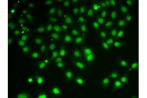 Immunofluorescence (IF) image for anti-Histone Deacetylase 5 (HDAC5) (AA 550-650) antibody (ABIN6141675)