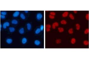 Immunofluorescence analysis of 293T cells using DiMethyl-Histone H3-K4 Polyclonal Antibody (Histone 3 Antikörper  (2meLys4))