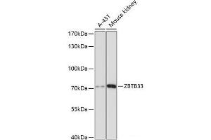 Western blot analysis of extracts of various cell lines using ZBTB33 Polyclonal Antibody at dilution of 1:3000. (ZBTB33 Antikörper)