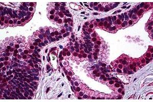 Human Prostate: Formalin-Fixed, Paraffin-Embedded (FFPE) (SMC1A Antikörper  (AA 366-466))