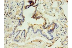 Immunohistochemistry of paraffin-embedded human lung tissue using ABIN7163325 at dilution of 1:100 (ABHD3 Antikörper  (AA 52-309))