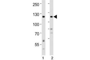 Western blot analysis of lysate from 1) HeLa and 2) SH-SY5Y cell line using Ror2 antibody at 1:1000. (ROR2 Antikörper  (AA 750-800))