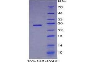 SDS-PAGE (SDS) image for Laminin, alpha 1 (LAMA1) ELISA Kit (ABIN6574168)