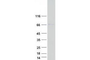 Western Blotting (WB) image for P21-Activated Kinase 1 (PAK1) (Transcript Variant 1) protein (Myc-DYKDDDDK Tag) (ABIN2728166)