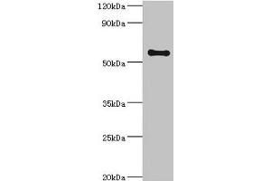 Western blot All lanes: SCP2 antibody at 6 μg/mL + A2780 whole cell lysate Secondary Goat polyclonal to rabbit IgG at 1/10000 dilution Predicted band size: 59, 16, 35, 51, 7, 55, 57 kDa Observed band size: 59 kDa (SCP2 Antikörper  (AA 1-322))