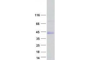 Western Blotting (WB) image for BarH-Like Homeobox 1 (BARHL1) protein (Myc-DYKDDDDK Tag) (ABIN2715151)