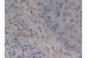 Syndecan 1 antibody  (AA 23-253)