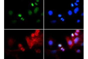 Fluorescence Microscopy (FM) image for anti-Histone 3 (H3) (H3K4me3), (pThr6) antibody (ABIN5706775)