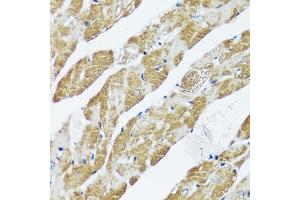 Immunohistochemistry of paraffin-embedded mouse heart using C antibody (ABIN7266047) at dilution of 1:100 (40x lens). (CASQ2 Antikörper  (AA 20-399))