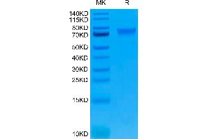 SDS-PAGE (SDS) image for Interleukin 6 Receptor, alpha (IL6RA) (AA 20-365) protein (His-Avi Tag) (ABIN7275036)
