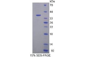 SDS-PAGE (SDS) image for Eukaryotic Translation Elongation Factor 1 delta (Guanine Nucleotide Exchange Protein) (EEF1D) (AA 2-281) protein (His tag) (ABIN6239574)