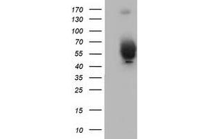Western Blotting (WB) image for anti-Bestrophin 3 (BEST3) antibody (ABIN1501729) (Bestrophin 3 Antikörper)