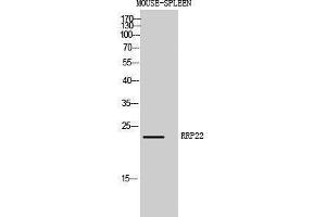 Western Blotting (WB) image for anti-RAS-Like, Family 10, Member A (RASL10A) (Internal Region) antibody (ABIN3186841)