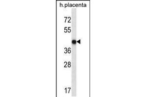 Western blot analysis in human placenta tissue lysates (35ug/lane). (OR10V1 Antikörper  (C-Term))