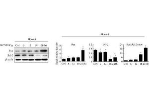 Expression of Bcl-2 family proteins in MCME-treated cancer cells.