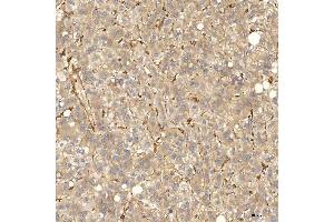 IHC analysis of SNX4 using anti-SNX4 antibody (ABIN7599406). (Sorting Nexin 4 Antikörper  (AA 1-450))